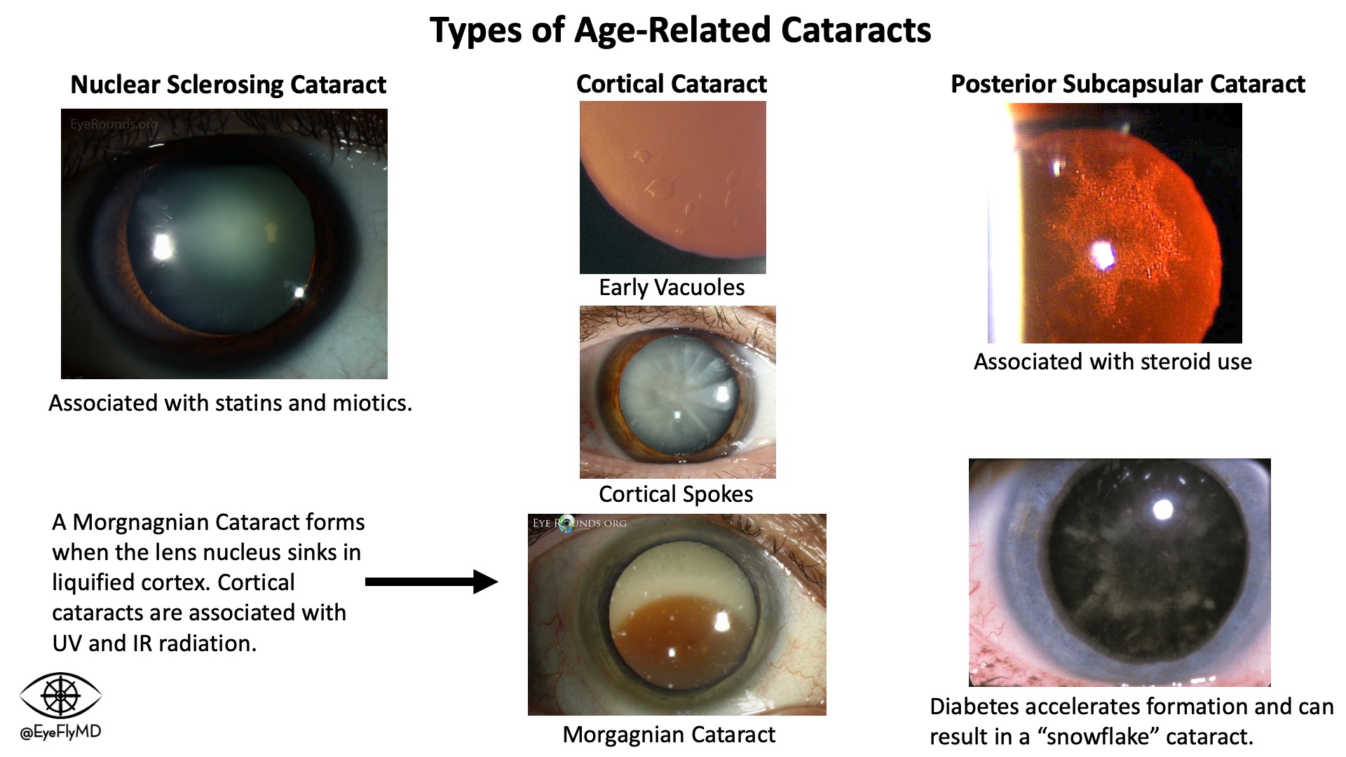 Educational and Matching in Ophthalmology Resources - Eye Fly MD